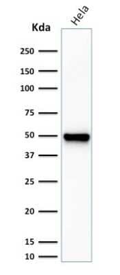 Western Blot: Fascin Antibody (FSCN1/416) [NBP2-44382]