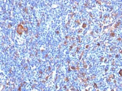 Immunohistochemistry-Paraffin: Fascin Antibody (FSCN1/417) - Azide and BSA Free [NBP2-47801]