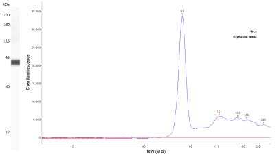 Simple Western: Fascin Antibody (FSCN1/417)Azide and BSA Free [NBP2-47801]
