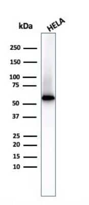 Western Blot: Fascin Antibody (FSCN1/417)Azide and BSA Free [NBP2-47801]