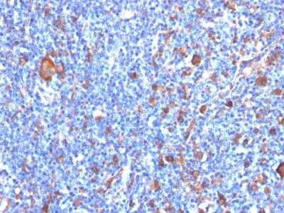 Immunohistochemistry-Paraffin: Fascin Antibody (FSCN1/417) - IHC-Prediluted [NBP2-48311]