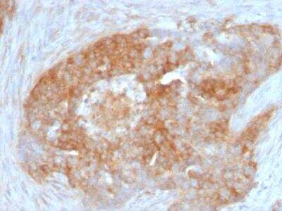 Immunohistochemistry-Paraffin: Fascin Antibody (FSCN1/417) - IHC-Prediluted [NBP2-48311]