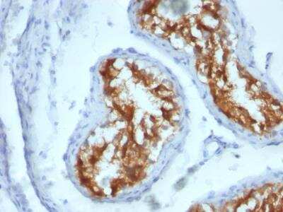 Immunohistochemistry-Paraffin: Fascin Antibody (FSCN1/417) - IHC-Prediluted [NBP2-48311]