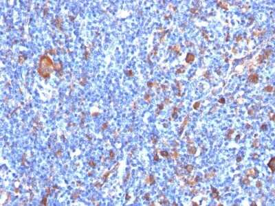 Immunohistochemistry-Paraffin: Fascin Antibody (FSCN1/417) [NBP2-44383]