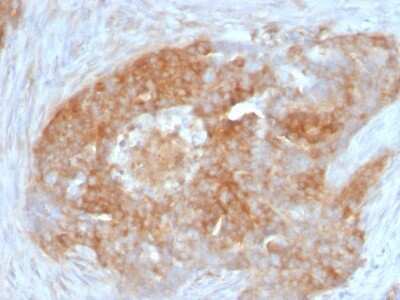 Immunohistochemistry-Paraffin: Fascin Antibody (FSCN1/417) [NBP2-44383]