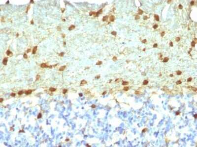 Immunohistochemistry-Paraffin: Fascin Antibody (FSCN1/418) - Azide and BSA Free [NBP2-47802]