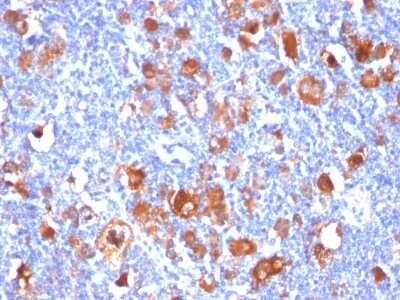 Immunohistochemistry-Paraffin: Fascin Antibody (FSCN1/418) - Azide and BSA Free [NBP2-47802]