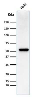 Western Blot: Fascin Antibody (FSCN1/418)Azide and BSA Free [NBP2-47802]