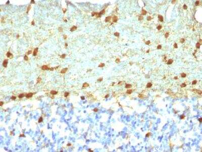 Immunohistochemistry-Paraffin: Fascin Antibody (FSCN1/418) - IHC-Prediluted [NBP2-48337]