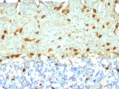Immunohistochemistry-Paraffin: Fascin Antibody (FSCN1/418) [NBP2-44385]