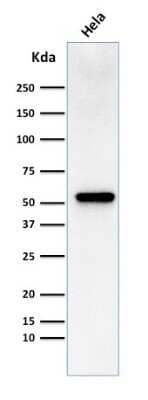 Western Blot: Fascin Antibody (FSCN1/418) [NBP2-44385]