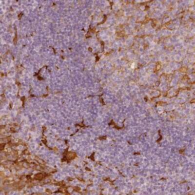 Immunohistochemistry-Paraffin: Fascin Antibody [NBP1-91887]
