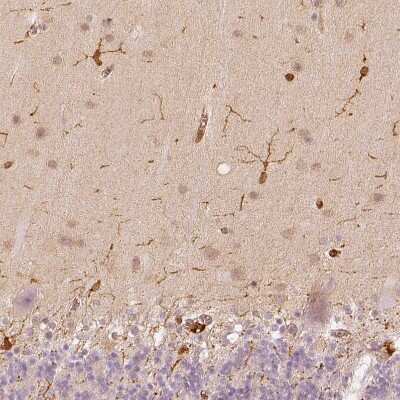 Immunohistochemistry-Paraffin: Fascin Antibody [NBP1-91887]