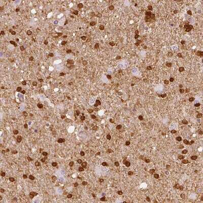Immunohistochemistry-Paraffin: Fascin Antibody [NBP1-91887]