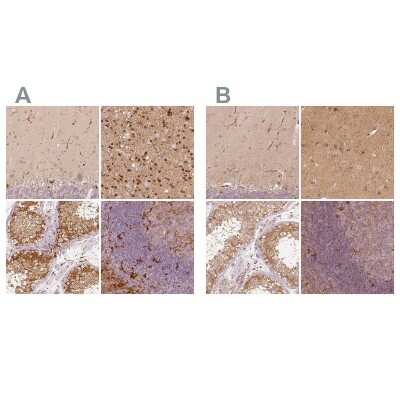 Immunohistochemistry-Paraffin: Fascin Antibody [NBP1-91887]