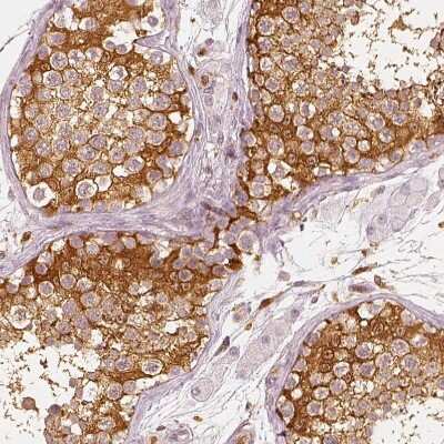 Immunohistochemistry-Paraffin: Fascin Antibody [NBP1-91887]