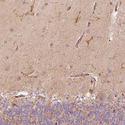 Immunohistochemistry-Paraffin: Fascin Antibody [NBP2-58042]