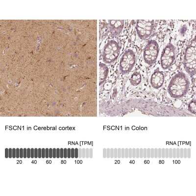 Immunohistochemistry-Paraffin: Fascin Antibody [NBP2-58042]