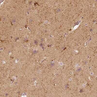 Immunohistochemistry-Paraffin: Fascin Antibody [NBP2-58042]