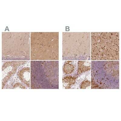 Immunohistochemistry-Paraffin: Fascin Antibody [NBP2-58042]