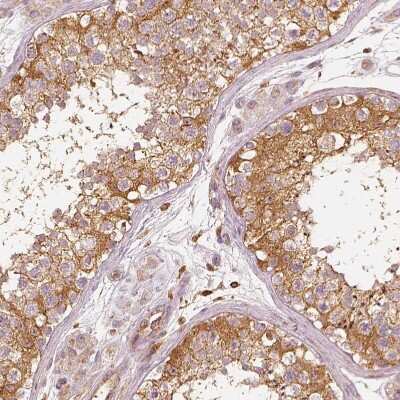 Immunohistochemistry-Paraffin: Fascin Antibody [NBP2-58042]