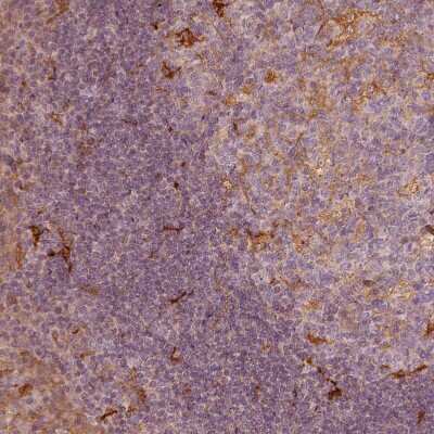 Immunohistochemistry-Paraffin: Fascin Antibody [NBP2-58042]