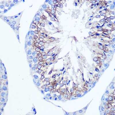 Immunohistochemistry-Paraffin: Fascin Antibody - BSA Free [NBP3-03708]
