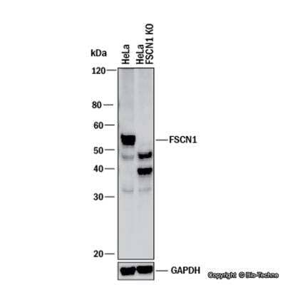 Knockdown Validated: Fascin Antibody [NBP1-91887]