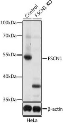 Western Blot: Fascin Antibody - BSA Free [NBP3-03708]