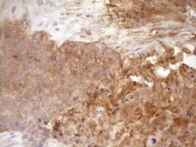 Immunohistochemistry: Fascin Antibody (OTI3B4) - Azide and BSA Free [NBP2-71294]