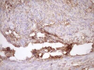 Immunohistochemistry: Fascin Antibody (OTI3B4) - Azide and BSA Free [NBP2-71294]