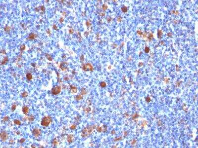 Immunohistochemistry-Paraffin: Fascin Antibody (SPM133) - IHC-Prediluted [NBP2-48312]