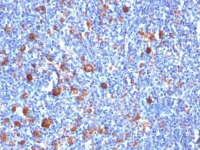 Immunohistochemistry-Paraffin: Fascin Antibody (SPM133) [NBP2-44384]