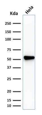 Western Blot: Fascin Antibody (SPM133) [NBP2-44384]