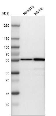 Western Blot: Fascin Antibody [NBP1-91887]