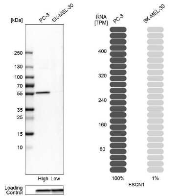 Western Blot: Fascin Antibody [NBP1-91887]