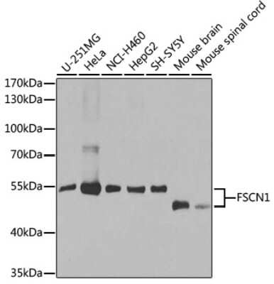 Western Blot: Fascin AntibodyBSA Free [NBP3-03708]