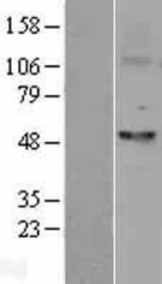 Western Blot: Fascin Overexpression Lysate [NBL1-10841]