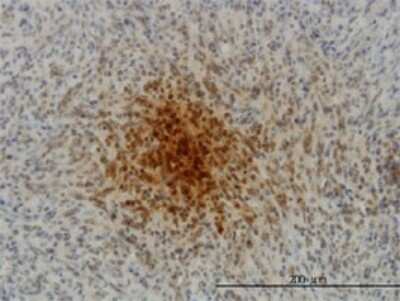 Immunohistochemistry-Paraffin: Fast skeletal myosin light chain 1 Antibody (2D9) [H00004632-M01]