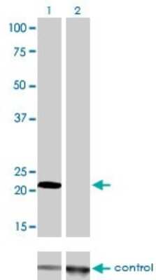 Western Blot: Fast skeletal myosin light chain 1 Antibody (2D9) [H00004632-M01]