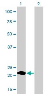 Western Blot: Fast skeletal myosin light chain 1 Antibody (2D9) [H00004632-M01]