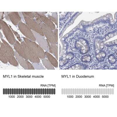 Immunohistochemistry-Paraffin: Fast skeletal myosin light chain 1 Antibody [NBP3-17102]