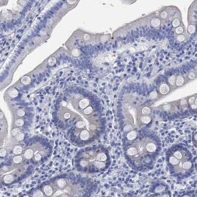 Immunohistochemistry-Paraffin: Fast skeletal myosin light chain 1 Antibody [NBP3-17102]