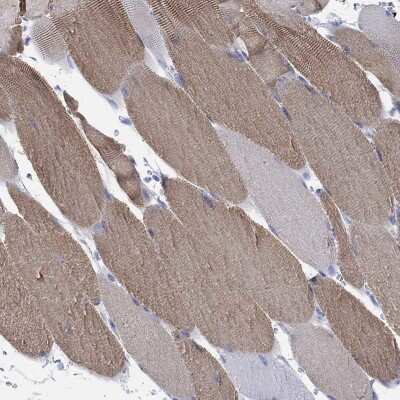 Immunohistochemistry-Paraffin: Fast skeletal myosin light chain 1 Antibody [NBP3-17102]