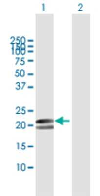 Western Blot: Fast skeletal myosin light chain 1 Antibody [H00004632-B01P]