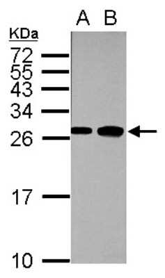 Western Blot: Fast skeletal myosin light chain 1 Antibody [NBP2-16433]
