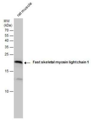 Western Blot: Fast skeletal myosin light chain 1 Antibody [NBP2-16433]