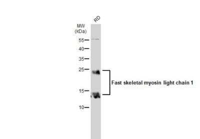 Western Blot: Fast skeletal myosin light chain 1 Antibody [NBP2-16433]