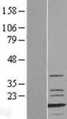 Western Blot: Fast skeletal myosin light chain 1 Overexpression Lysate [NBL1-13423]