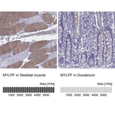 Immunohistochemistry-Paraffin: Fast skeletal myosin light chain 2 Antibody [NBP2-62625]